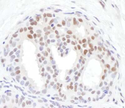 Immunohistochemistry: Chk1 [p Ser317] Antibody [NBP2-37703]